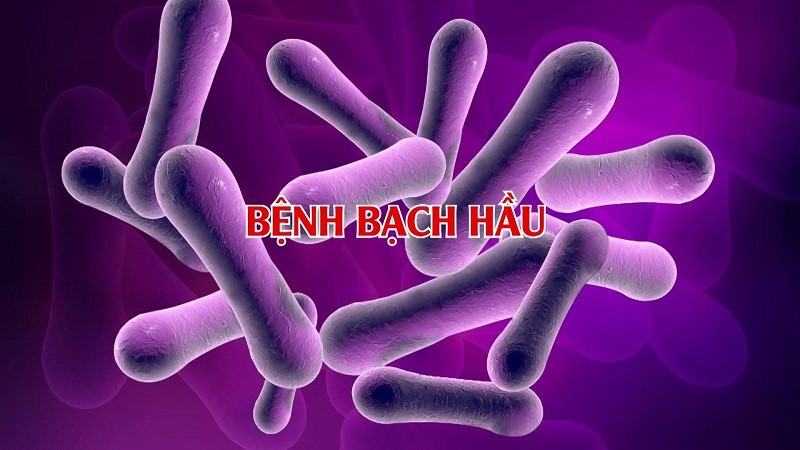 bạch hầu