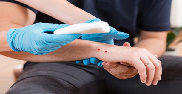 Lưu ý trong sơ cứu khi bị rắn cắn
